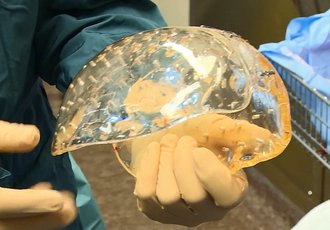 Vsadek je skoraj v celoti sestavljen le iz plastike.